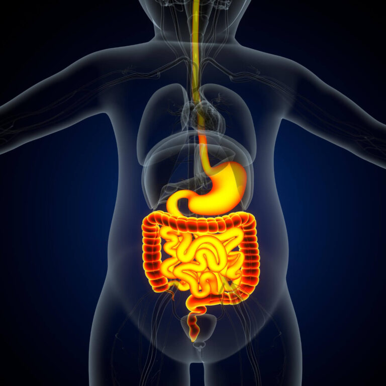 Acupuncture treatment on the stomach area to relieve digestive discomfort.